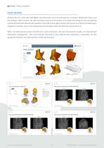 TALUS OSTEOTOMY-5