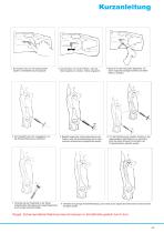 Intra-Nail-3