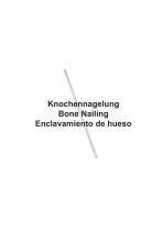 ‌ Osteosynthese-3