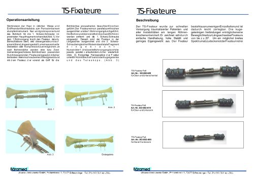 TS-Fixateure 2