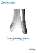 ArtFonks Double Button Lift System_Syndesmosis