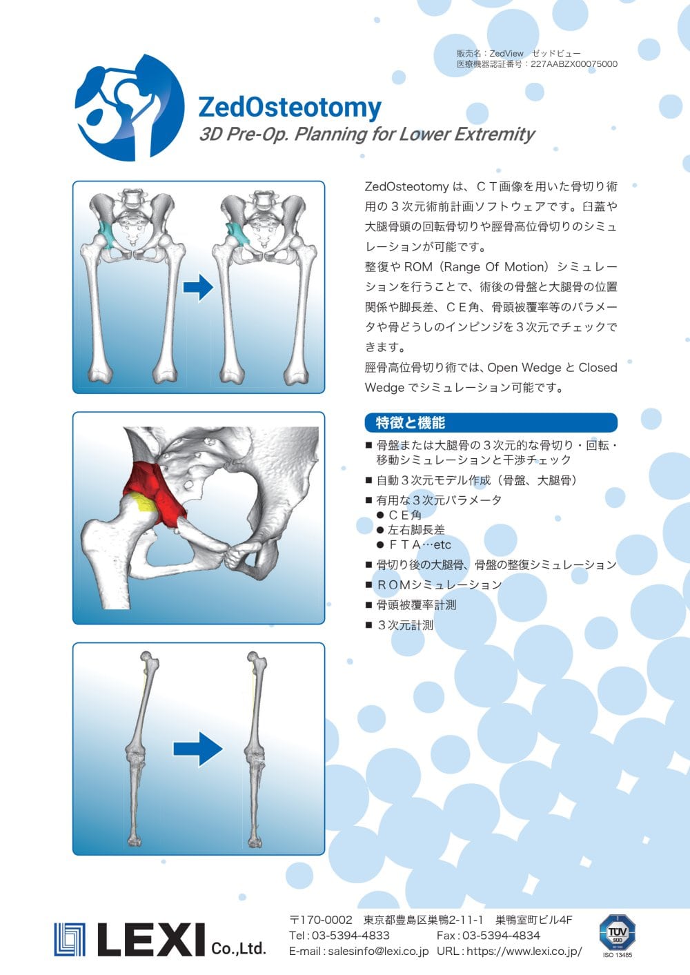 ZedOsteotomy - LEXI Co.