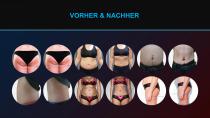 EMS Magshape-12