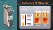 Mikroneedling RF-11