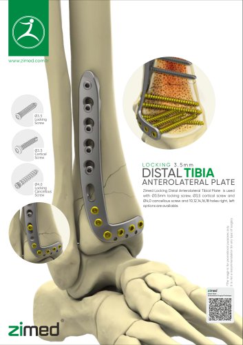 distal_tibia_anterolateral_tibia_plate
