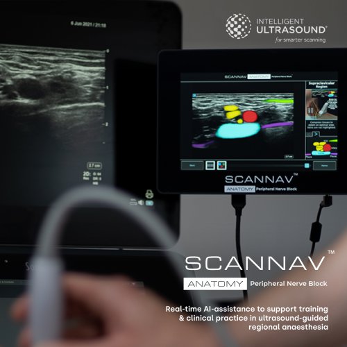 ScanNav Anatomy PNB Brochure