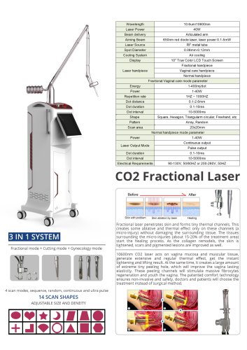Stelle Laser-Co2 Fractional Laser Scar Removal Machine-FL1