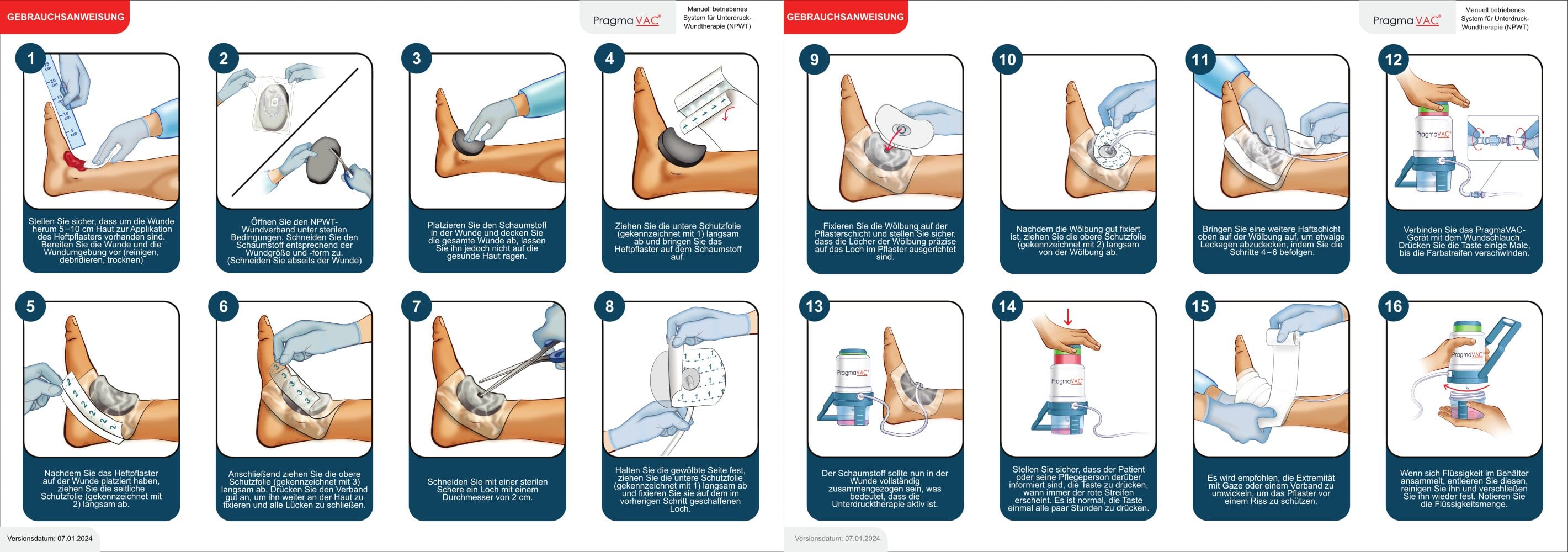 Wound Dressing Application Instuctions - DE - PragmaVAC