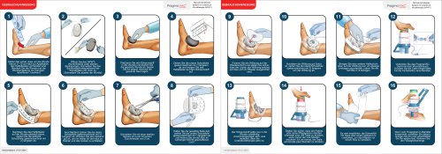 Wound Dressing Application Instuctions - DE