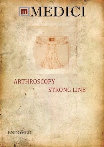 ARTHROSCOPY
