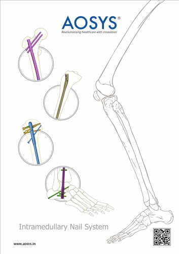 Interlocking Nailing System