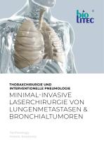 Thorax–Chirurgie und Interventionelle Pneumologie-1