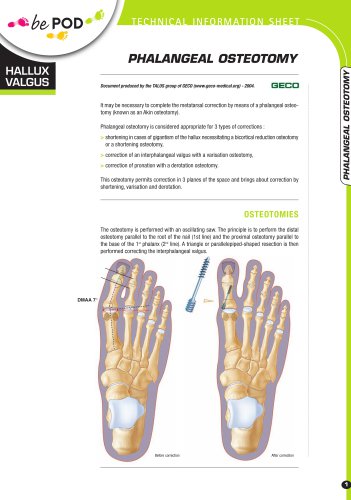 PHALANGEAL OSTEOTOMY