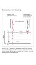 Infrarot Eindringtiefen in die Haut - 1