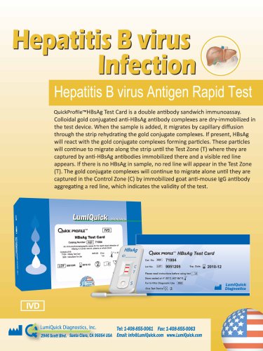 Hepatit B virus infection