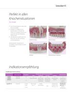 copaSKY – Implantatsystem-7
