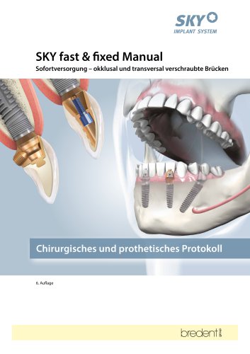 SKY fast & fixed – Manual