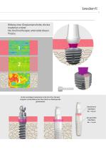 SKY Implantatsystem – blueSKY, narrowSKY, classicSKY-11
