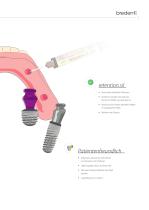 SKY TiSi.snap & retention.sil-5