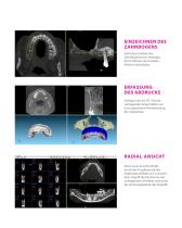 BTI Scan® 4 - Planungs-Software für die Orale Implantologie - 4
