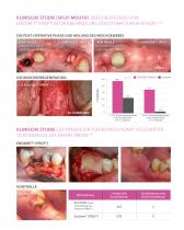 Kit PRGF – ENDORET® - Extraktionsalveolen - 4