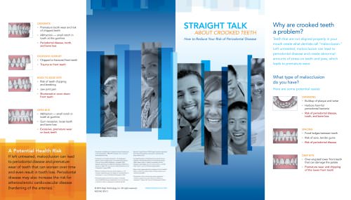 Invisalign Straight Talk Brochure