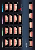 Tooth mould guide NFC+ - 7