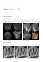 3D Accuitomo 170 - 2