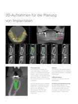 Veraviewepocs 3D R100 - 8