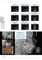 Brochure I-Max XPro - 13