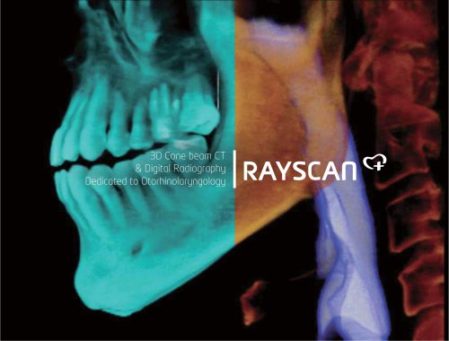 RAYSCAN-m-plus