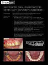 Beilage Prettau® 3 Dispersive® - 2