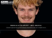 Brochure from scan to splint – 100% digital