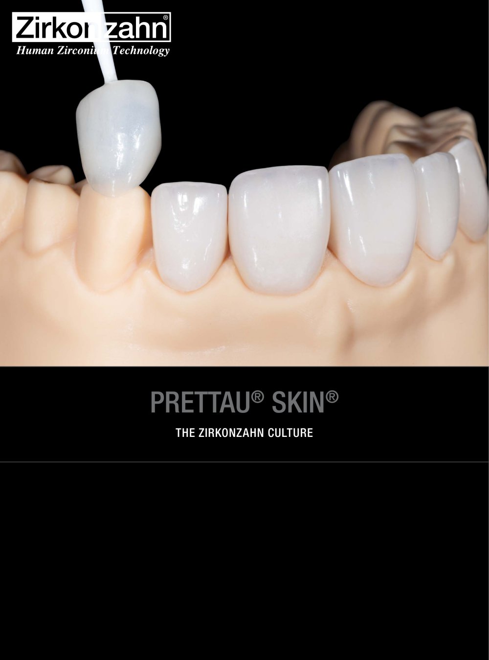 Case gallery Prettau&reg; Skin&reg; - Zirkonzahn