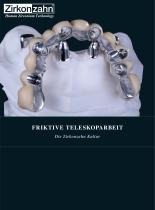 Fallgalerie Friktive Teleskoparbeit - 1