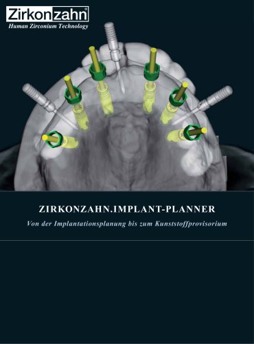 Fallgalerie Implant-Planner Workflow