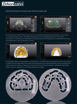 Fallgalerie Implant-Planner Workflow - 2