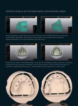 Fallgalerie Implant-Planner Workflow - 3