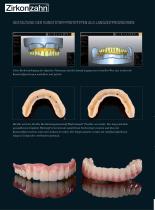 Fallgalerie Implant-Planner Workflow - 5