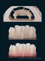 Fallgalerie Multistratum® Flexible - 3