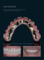 Fallgalerie Prettau® 2 Dispersive® - 3