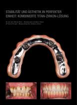 Fallgalerie Prettau® 2 Dispersive® - 3