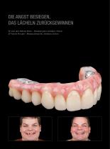 Fallgalerie Prettau® 2 Dispersive®-3