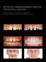 Fallgalerie Prettau® 3 Dispersive® - 3