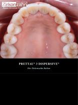 Fallgalerie Prettau® 3 Dispersive® - 1