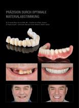 Fallgalerie Prettau® 3 Dispersive® auf Ice Plus-3