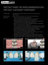 Fallgalerie Prettau® 4 Anterior® Dispersive® - 2