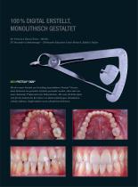 Fallgalerie Prettau® Skin®2022 - 3