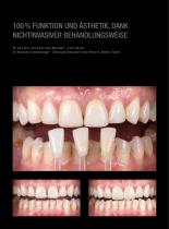 Fallgalerie Prettau® Skin® 2024 - 3