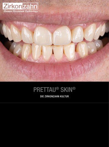 Fallgalerie Prettau® Skin®